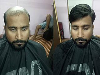 Raj Hair Wig Shop in Delhi, Raj Hair Solution Raj Hair Solution