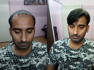 Raj Hair Wig Shop in Delhi, Raj Hair Solution Raj Hair Solution