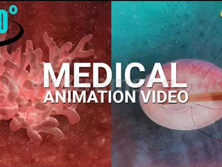 360° Panoramic interactive virtual tours of 3D Medical Animation by Virtual Reality Studio - Columbus, Ohio, Yantram Animation Studio Corporation Yantram Animation Studio Corporation