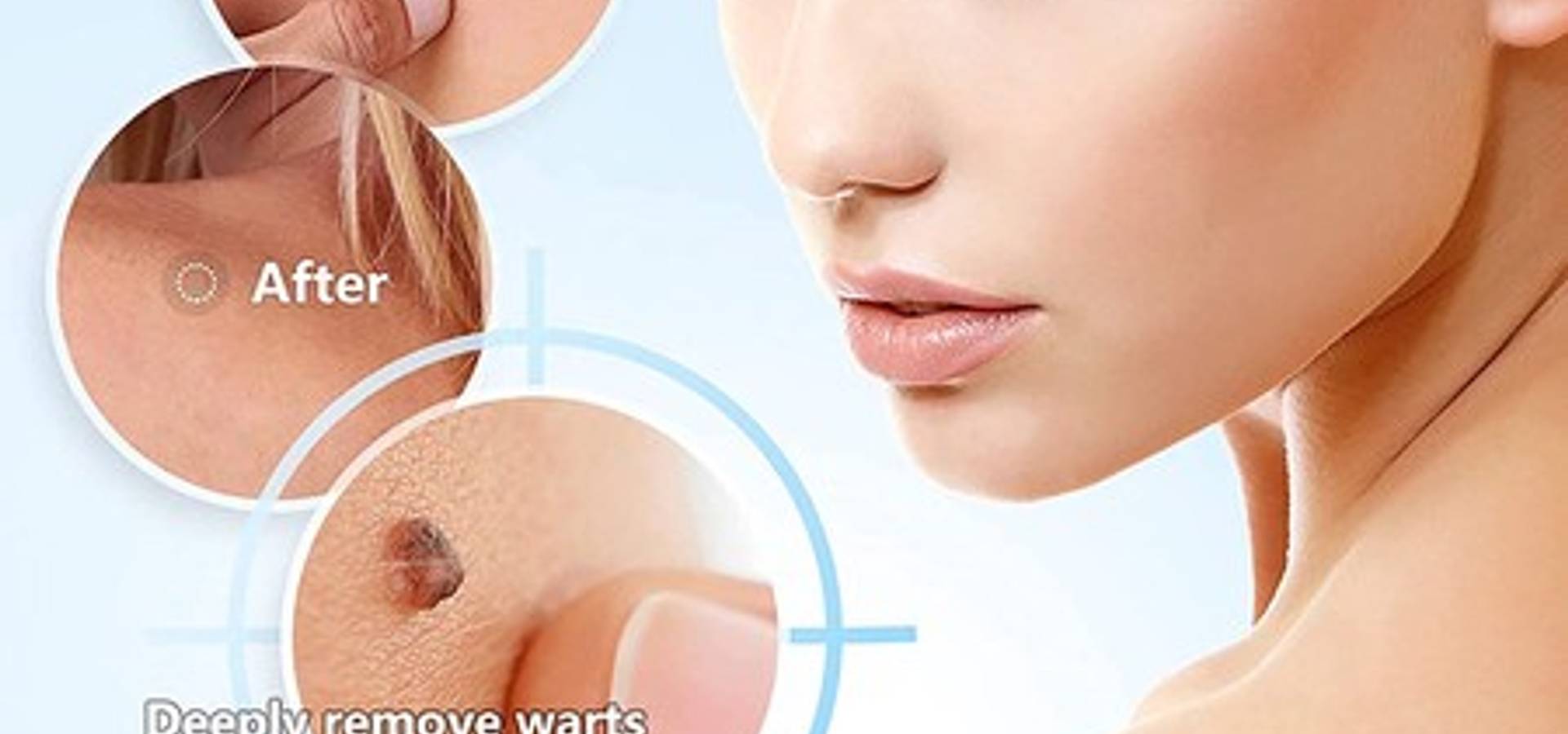Amarose Skin Tag Remover Reviews – Does It Really Work or Scam?