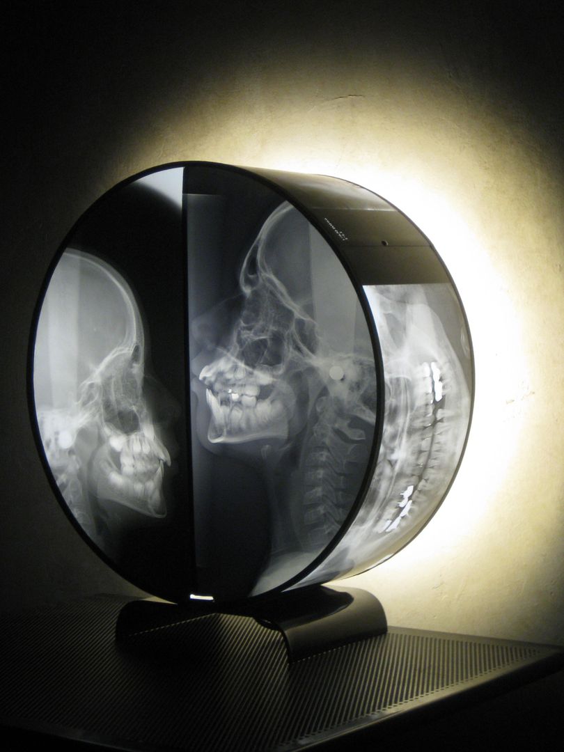 Lampe ronde , Anatomik Anatomik Eclectic style living room Lighting